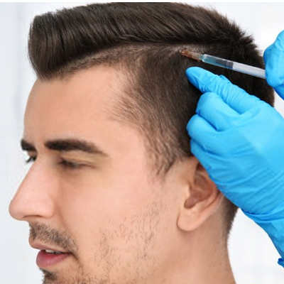 Hair Transplantation Cost in Anand Lok