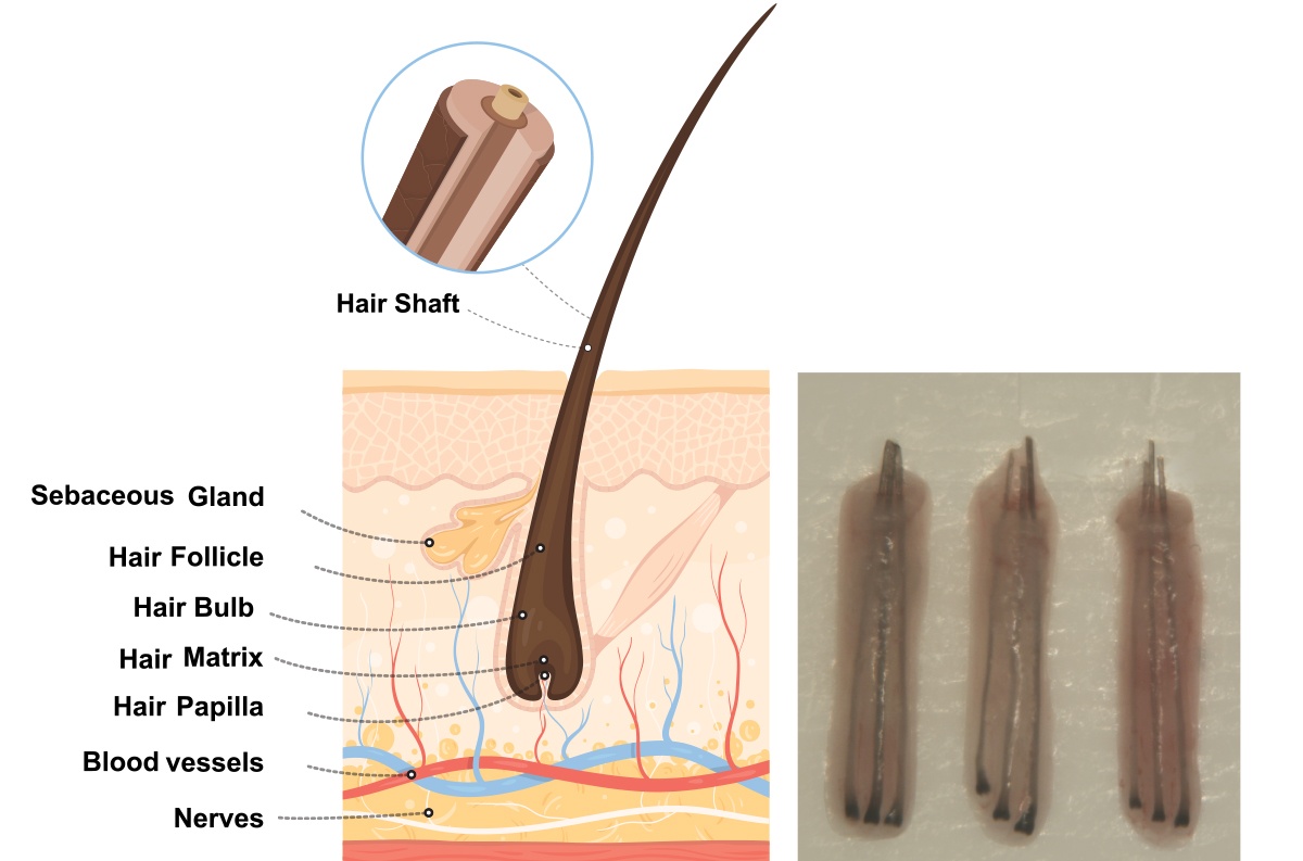 What is a Graft/ Hair Follicle?