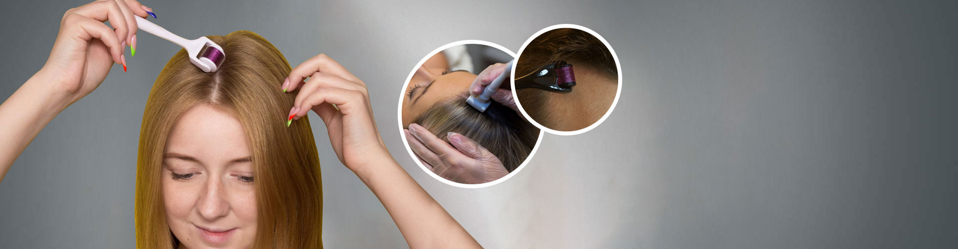 Derma Roller