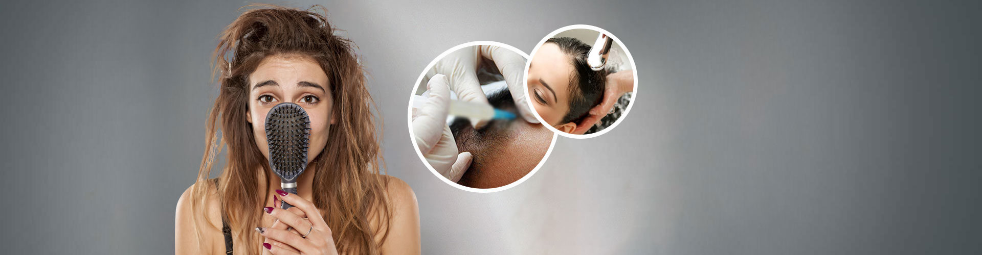 Hair Fall Treatment in East Delhi