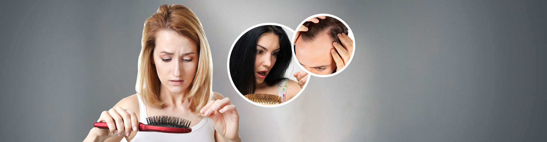 Hair Loss Treatment in Tagore Garden