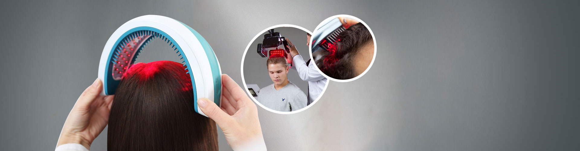 Laser Hair Loss Treatment