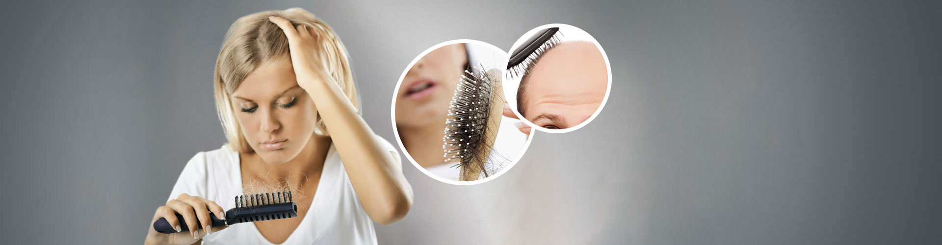 Types of Hair Loss in Lajpat Nagar