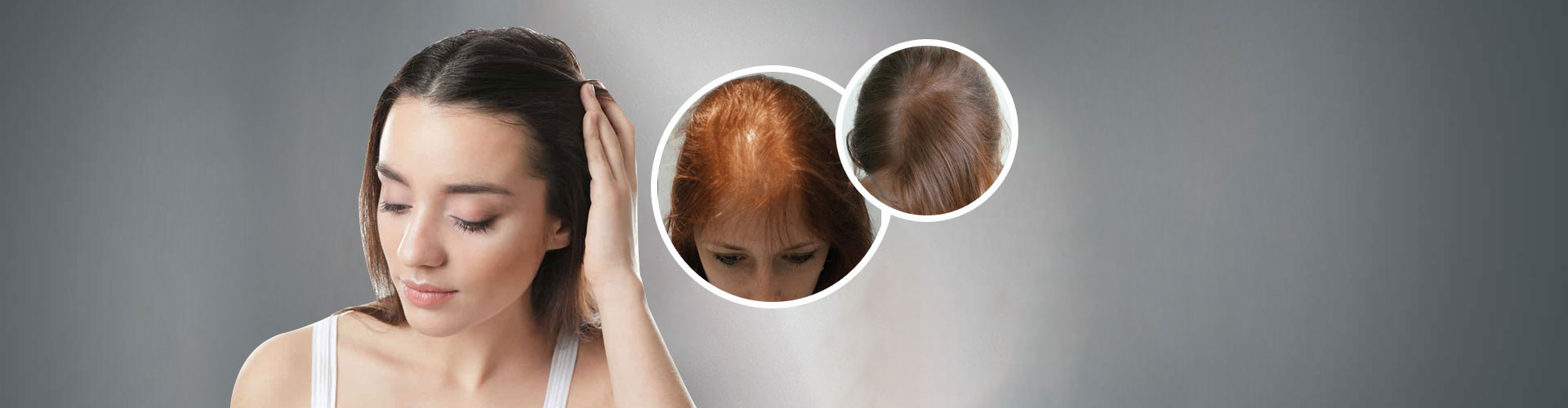 Women/Female Hair Transplant