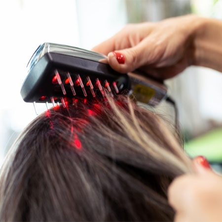 Laser Hair Loss Treatment in Dwarka