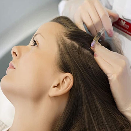 Mesotherapy for Hair Loss in Saket