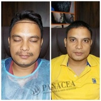 Panacea Global