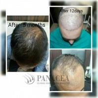 Panacea Global
